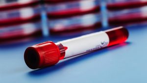 Incidente da ubriachi: test sangue ospedale non può essere utilizzato